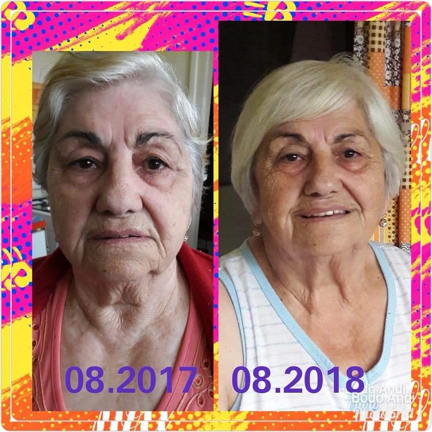 kết quả age pill từ bà 80 tuổi